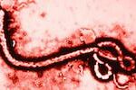 Ebola: di che si tratta veramente? Una riflessione a tutto campo.