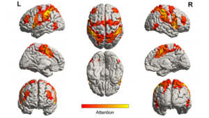 musica contro l'alzheimer