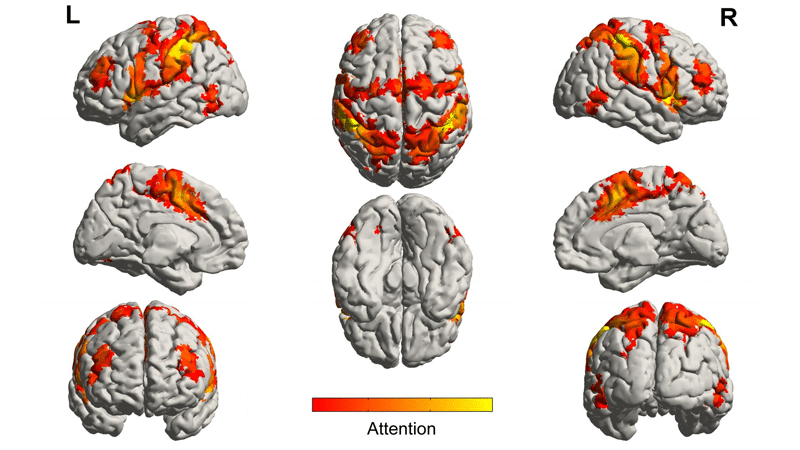 Scopri di più sull'articolo Musica contro l’Alzheimer!